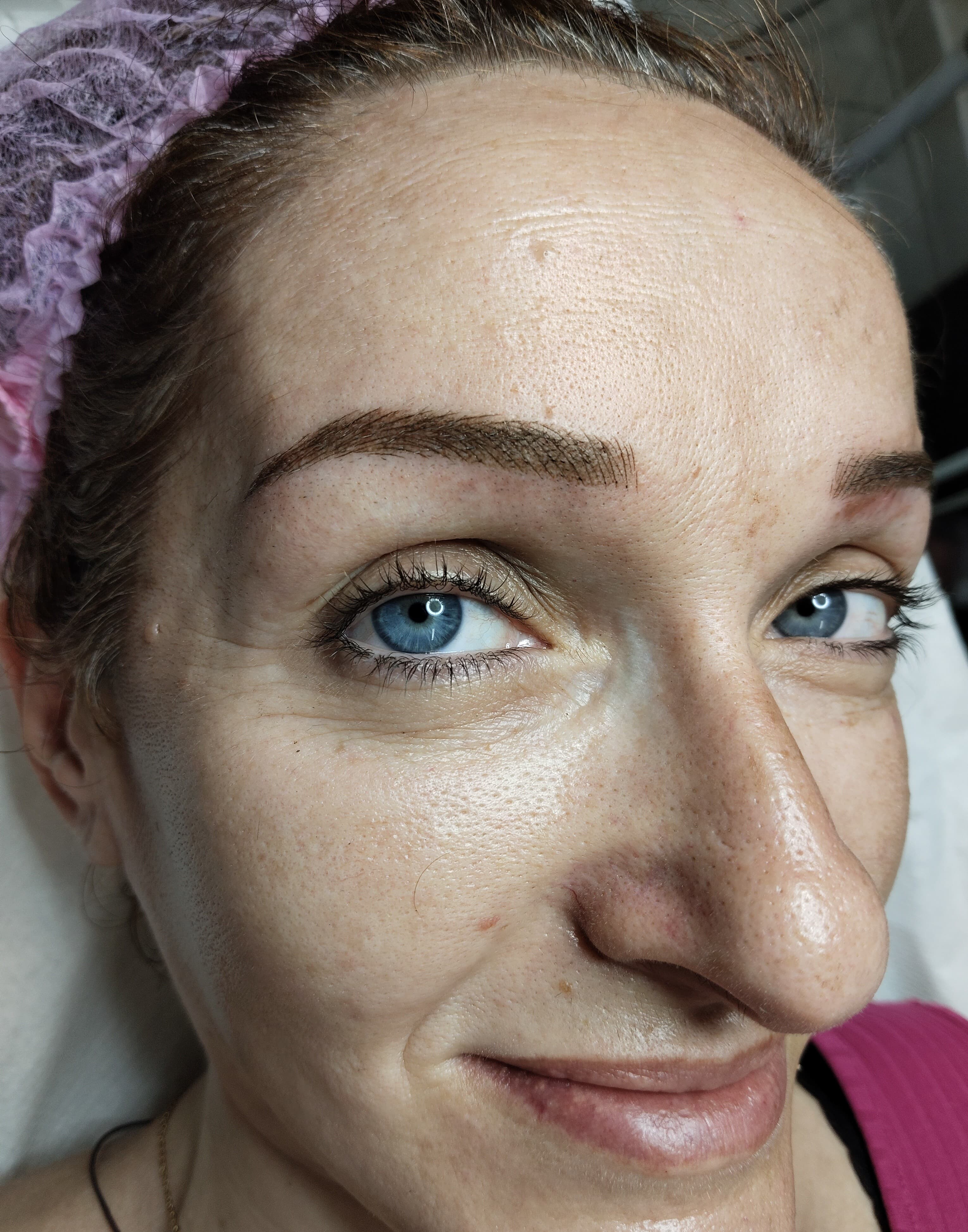 Resultado de Micropigmentación + Microblading en Punto Alto