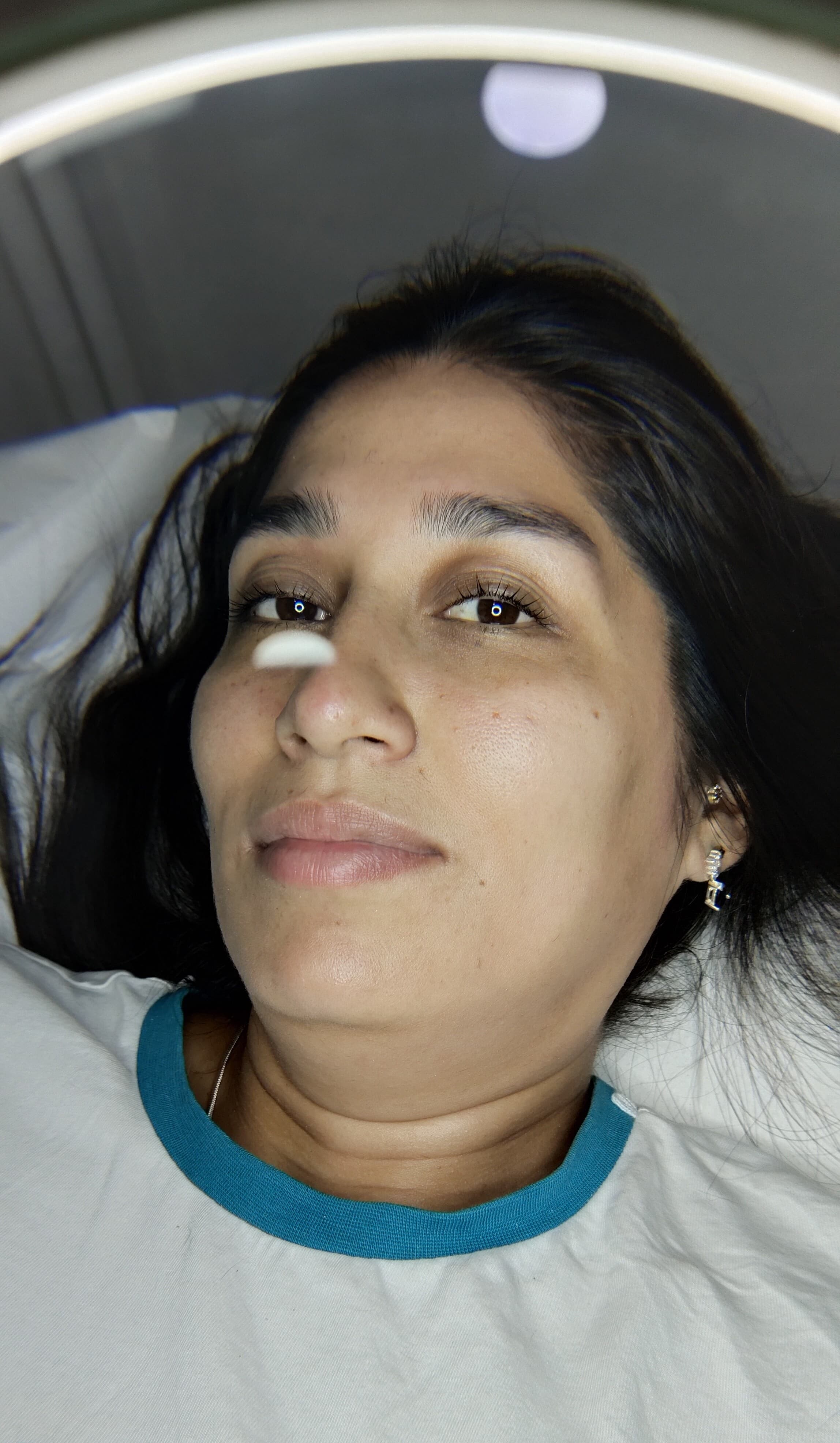 Resultado de Higiene facial profunda en Punto Alto